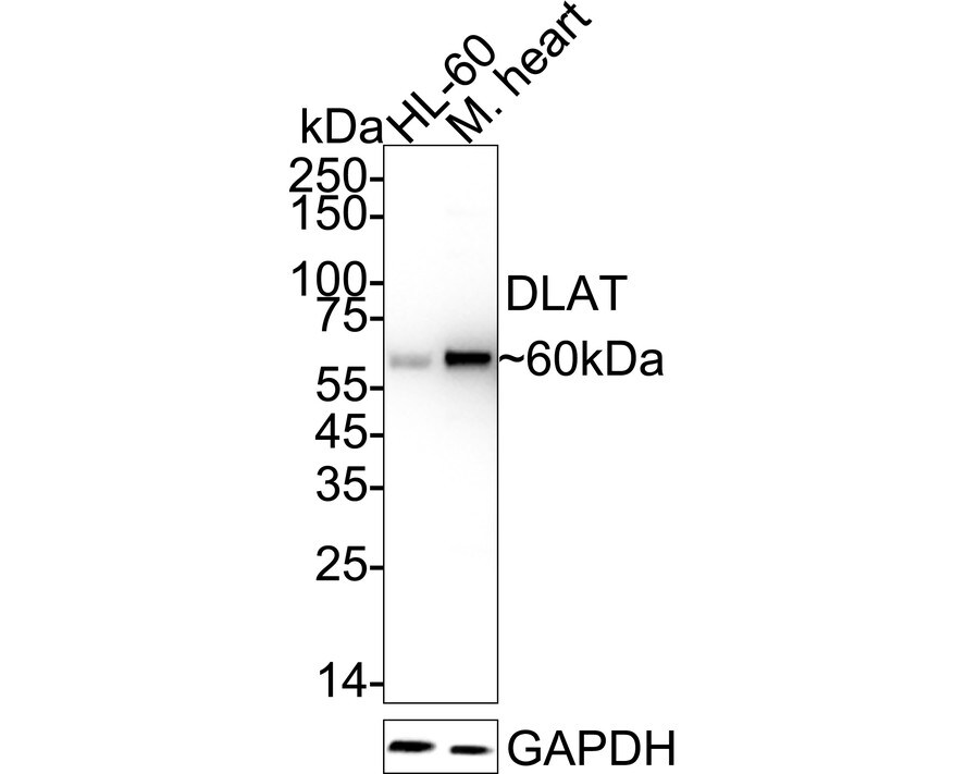 Pyruvate Dehydrogenase E2 Antibody (JE34-38) Western Blot: Pyruvate Dehydrogenase E2 Antibody (JE34-38) [NBP3-32880]