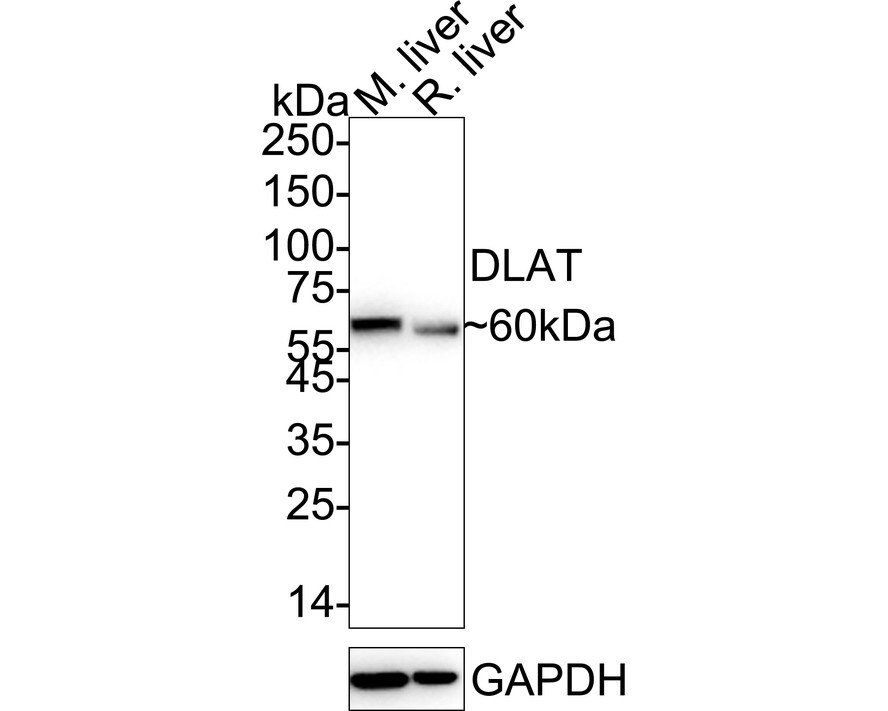 Pyruvate Dehydrogenase E2 Antibody (JE34-38) Western Blot: Pyruvate Dehydrogenase E2 Antibody (JE34-38) [NBP3-32880]