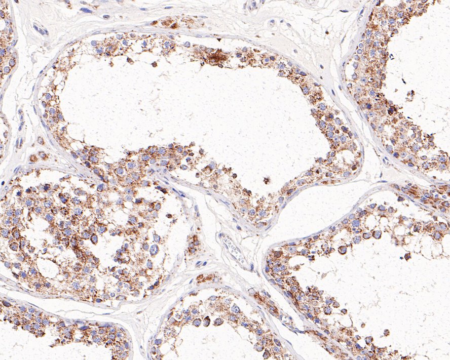 Pyruvate Dehydrogenase E2 Antibody (JE34-38)