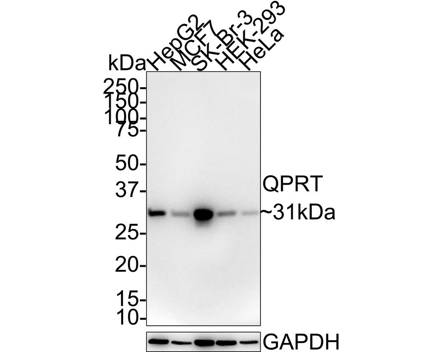 QPRT Antibody (PSH01-31) Western Blot: QPRT Antibody (PSH01-31) [NBP3-32881]