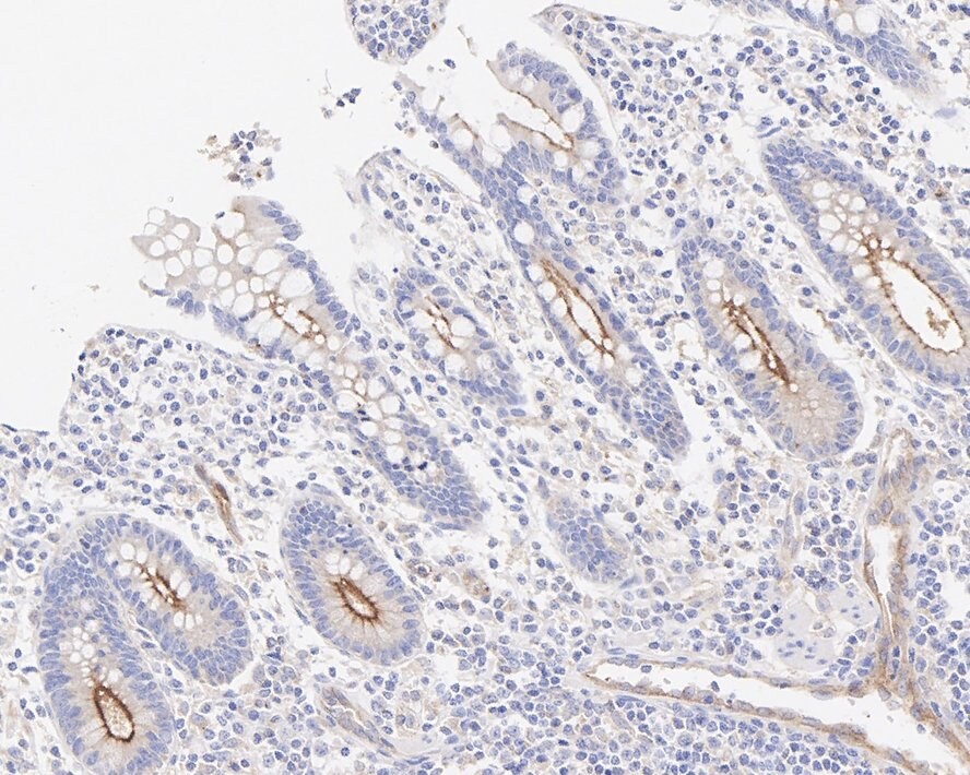 Rab11A Antibody (JE42-00)
