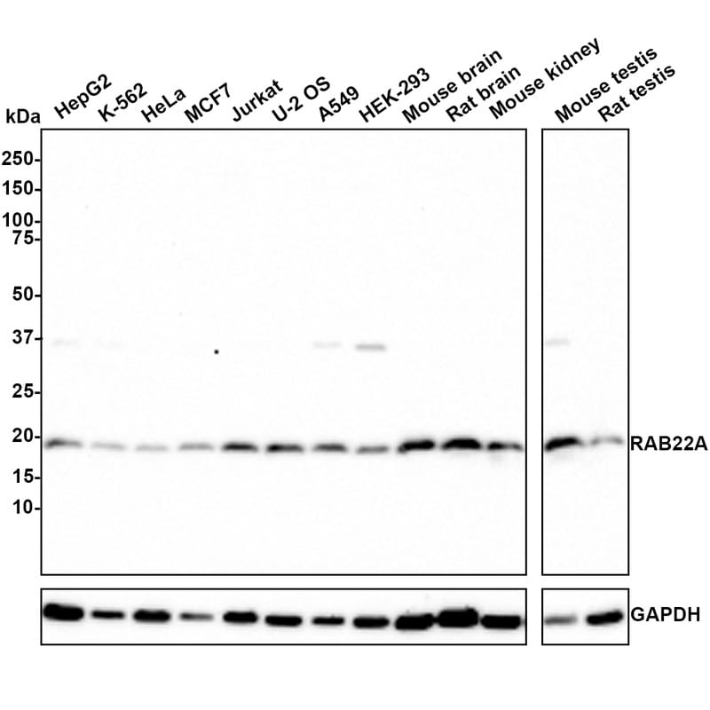 RAB22A Antibody (JE66-08) Western Blot: RAB22A Antibody (JE66-08) [NBP3-32885]
