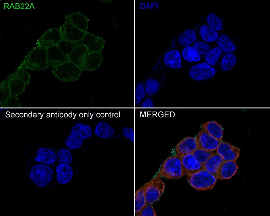 RAB22A Antibody (JE66-08)