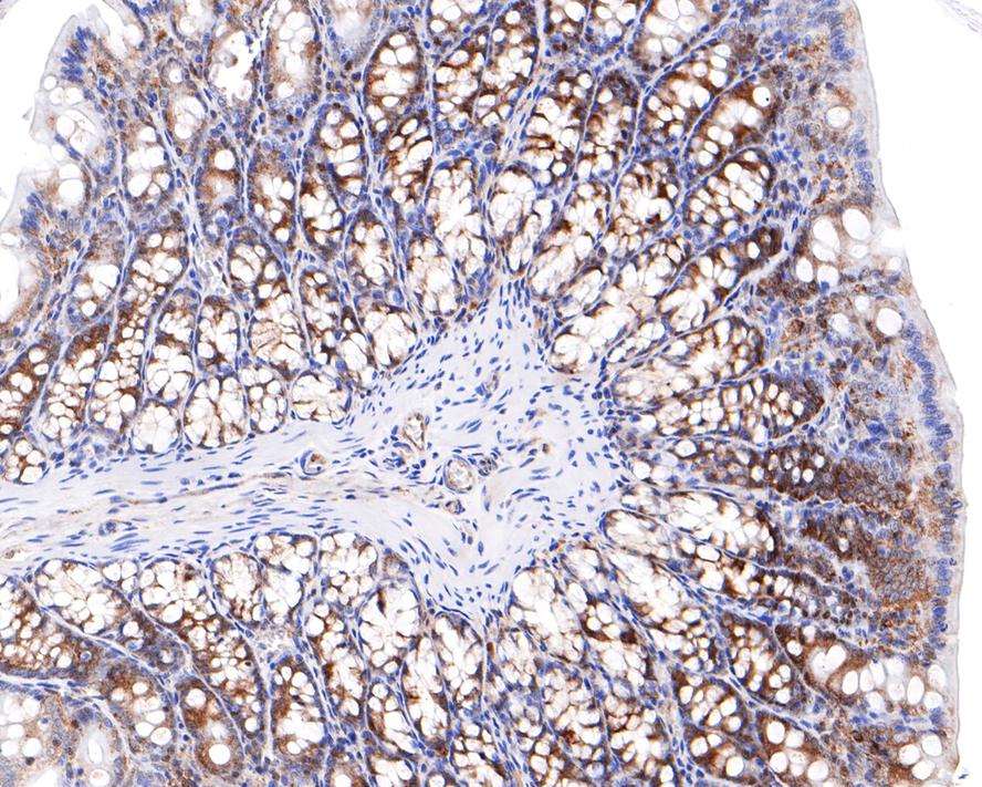 RASEF Antibody (JE65-33)