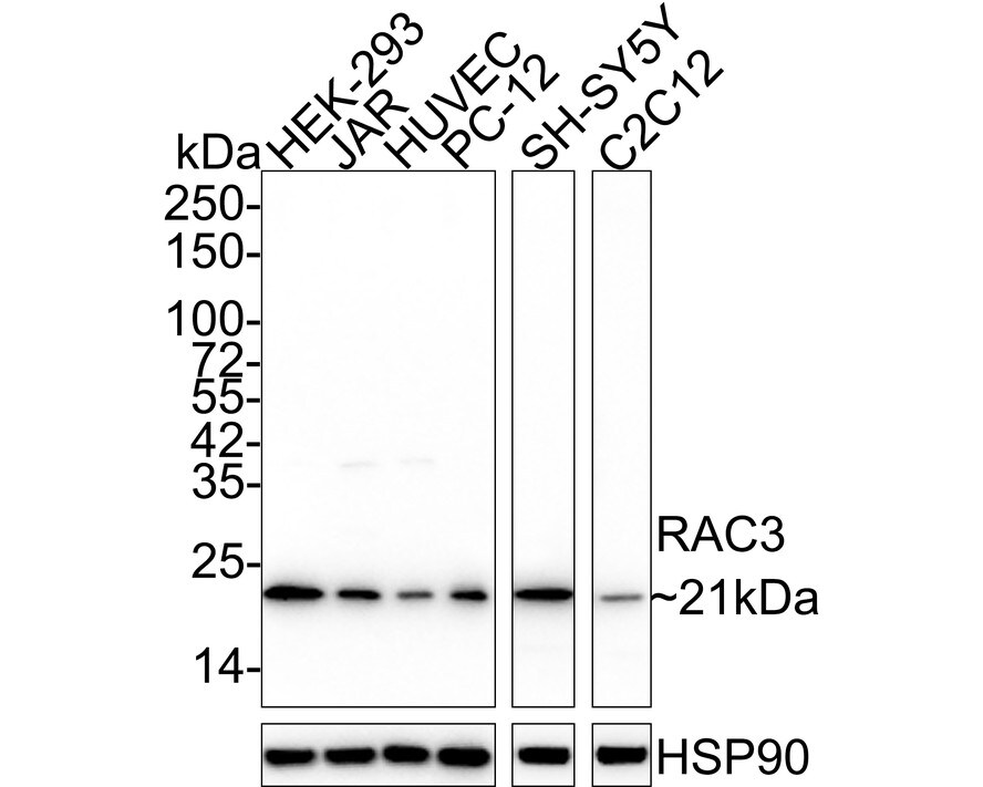 RAC3 Antibody (JE56-48) Western Blot: RAC3 Antibody (JE56-48) [NBP3-32888]
