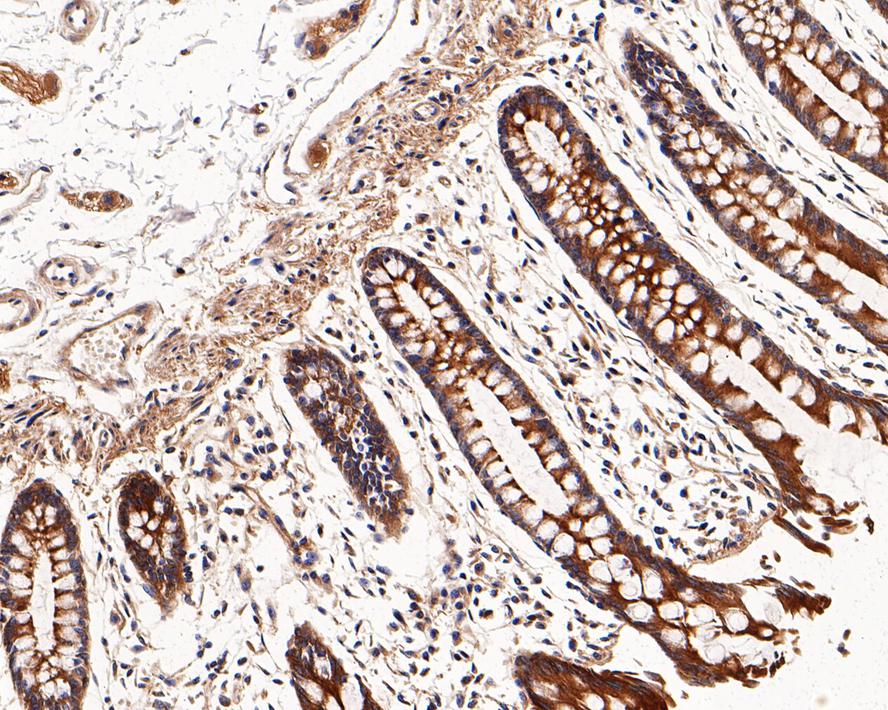 RalA Antibody (JE54-12)