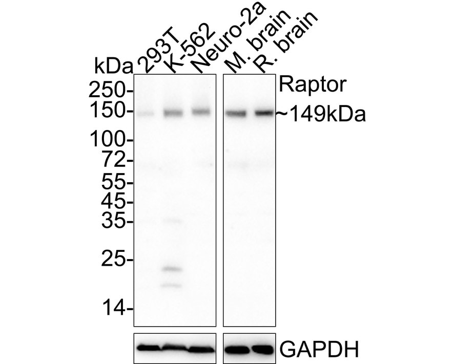RPTOR Antibody (JE59-39) Western Blot: RPTOR Antibody (JE59-39) [NBP3-32894]