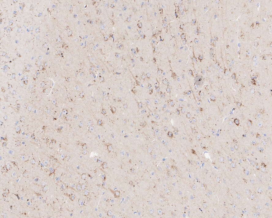RPTOR Antibody (JE59-39)