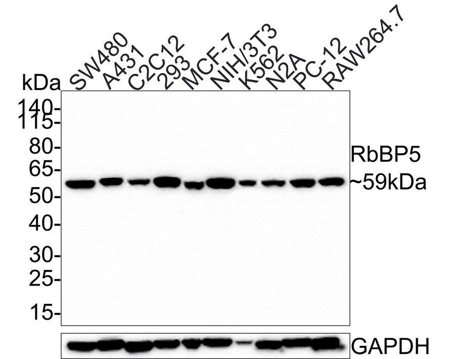 RbBP5 Antibody (PSH0-15) Western Blot: RbBP5 Antibody (PSH0-15) [NBP3-32895]