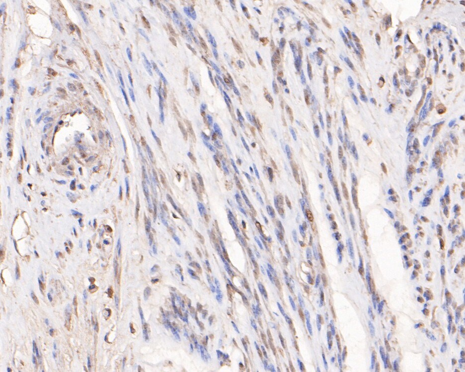 RbAp46 Antibody