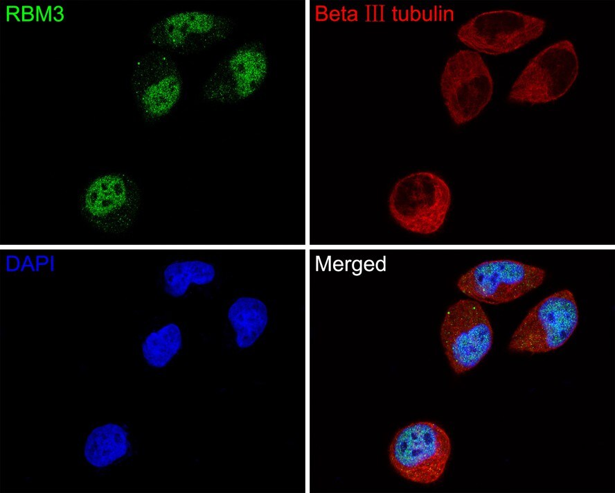 RBM3 Antibody (JE63-84)