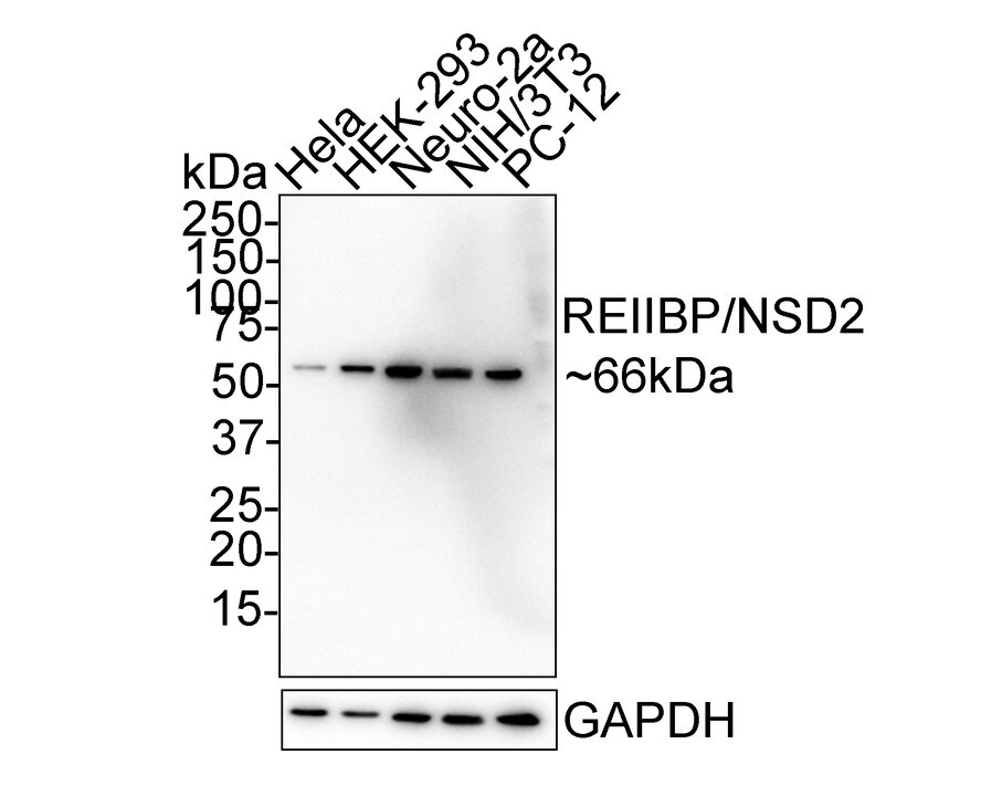 WHSC1 Antibody (PSH02-39) Western Blot: WHSC1 Antibody (PSH02-39) [NBP3-32901]