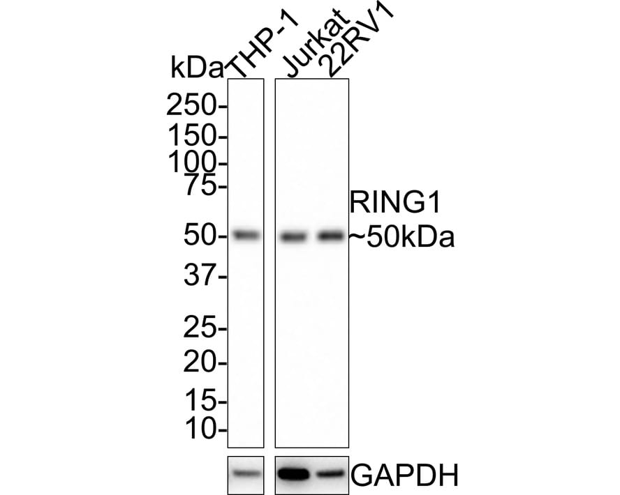 RING1 Antibody (JE34-66)
