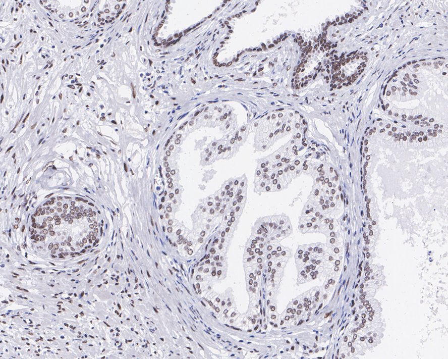 RING1 Antibody (JE34-66)