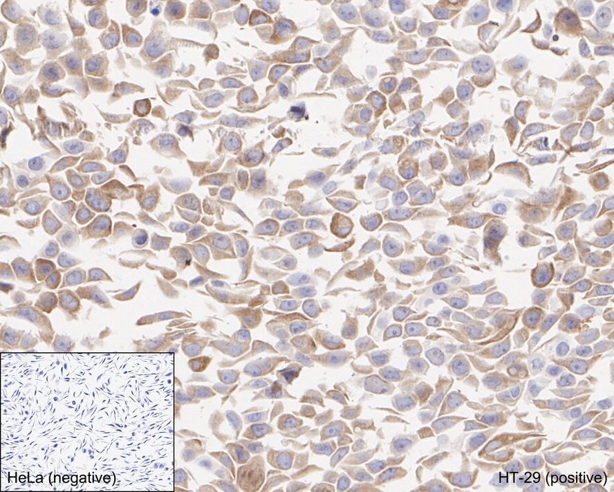 RIPK3/RIP3 Antibody (PSH04-79)