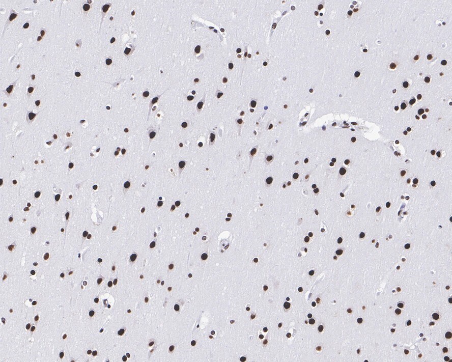 RNA Helicase A Antibody (JE34-97)