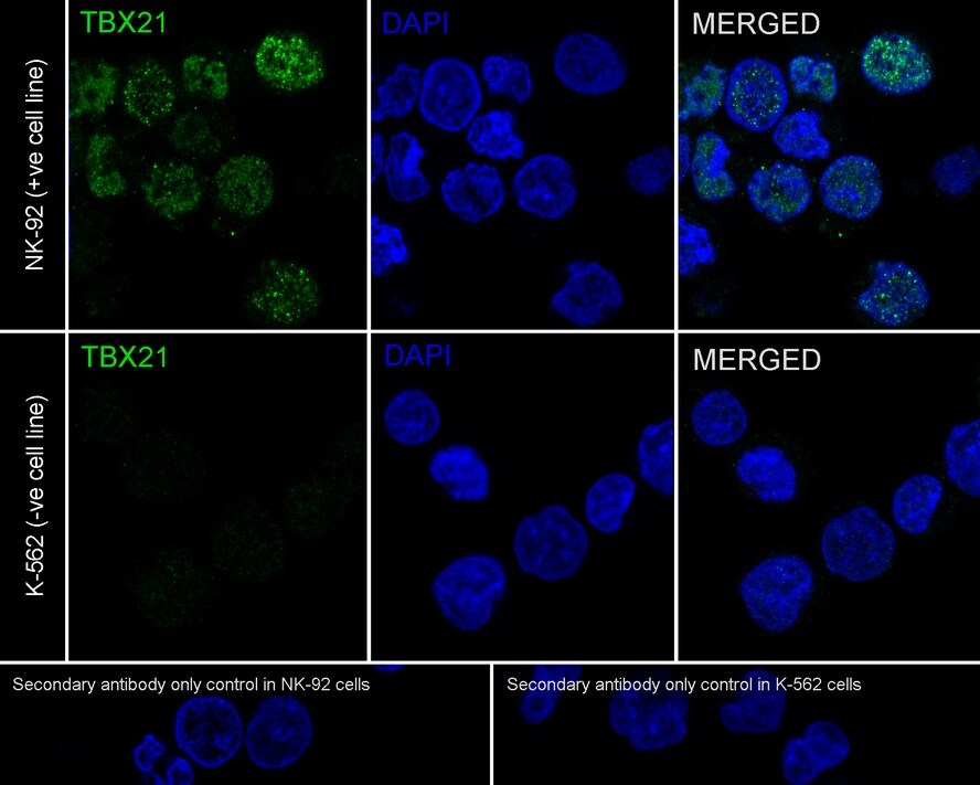 T-bet/TBX21 Antibody (JE60-20)