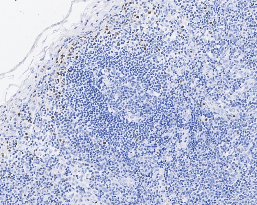 T-bet/TBX21 Antibody (JE60-20)