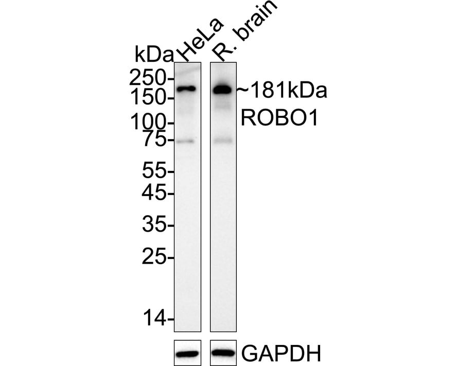 ROBO1 Antibody (10E2-R) Western Blot: ROBO1 Antibody (10E2-R) [NBP3-32913]