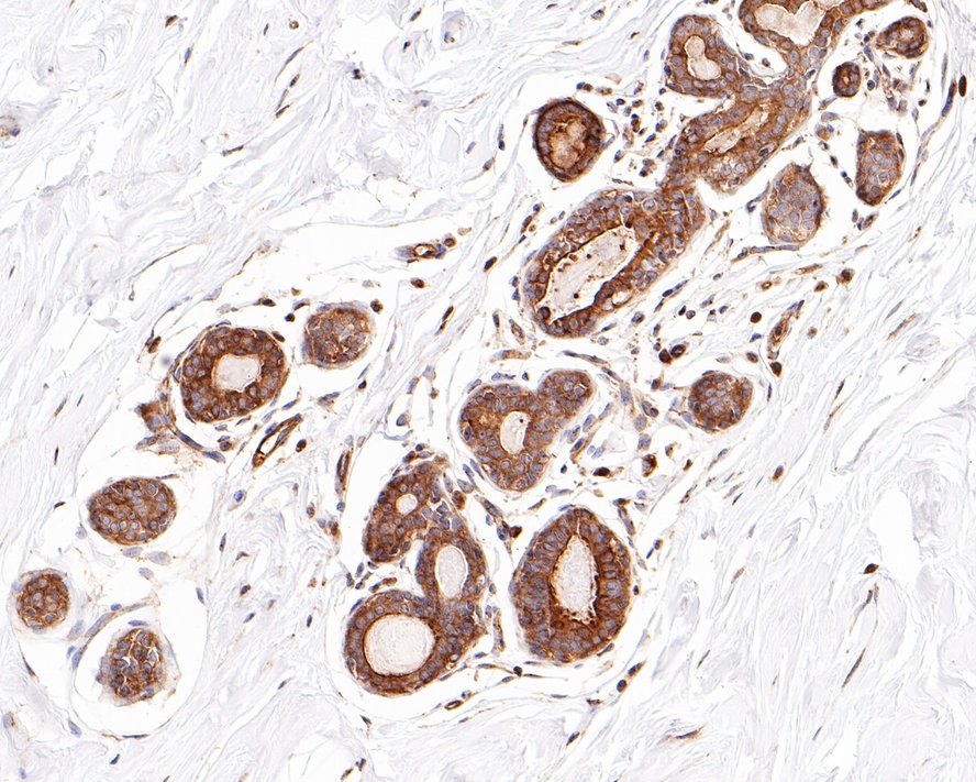 ROBO1 Antibody (10E2-R)