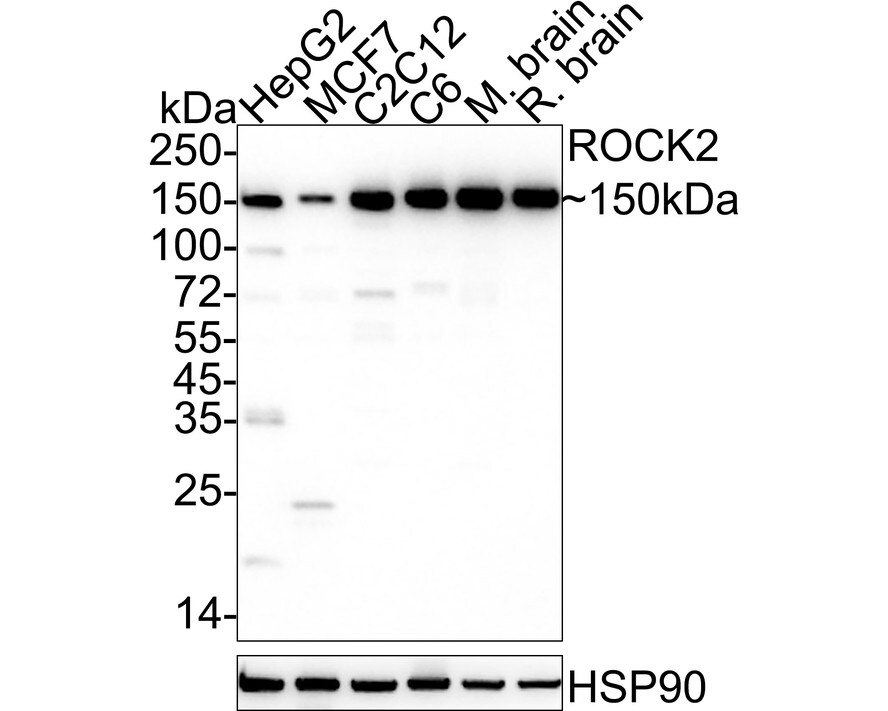 ROCK2 Antibody (JE31-36) Western Blot: ROCK2 Antibody (JE31-36) [NBP3-32914]