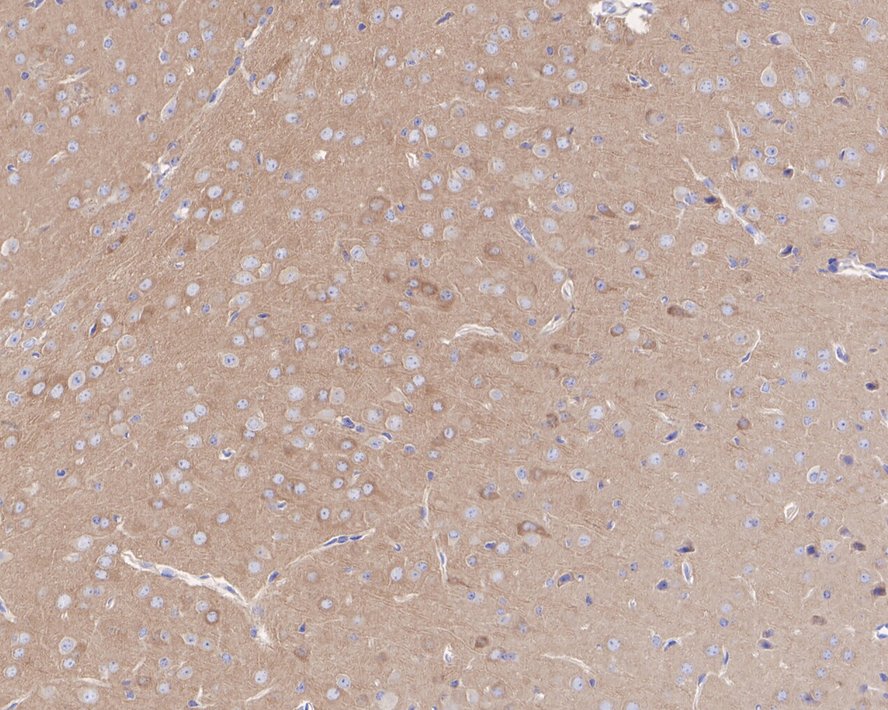 ROCK2 Antibody (JE31-36)