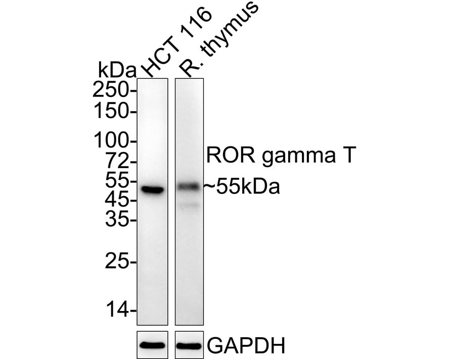 ROR gamma t/RORC2/NR1F3 Antibody (PSH04-38)