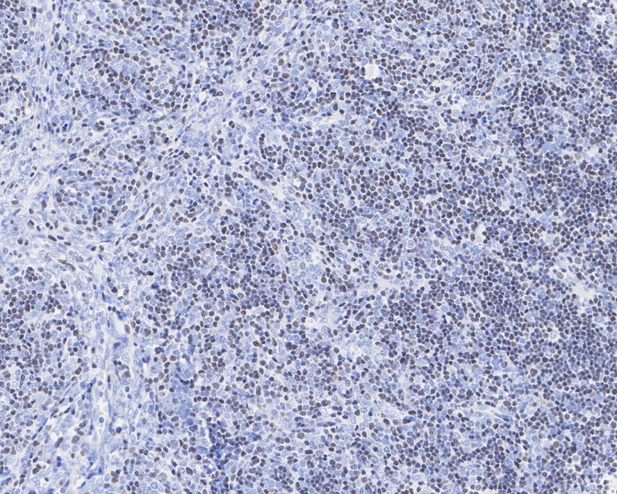 ROR gamma t/RORC2/NR1F3 Antibody (PSH04-38)