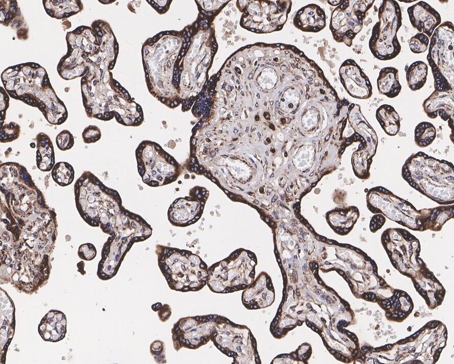 ROR2 Antibody (JE37-72)
