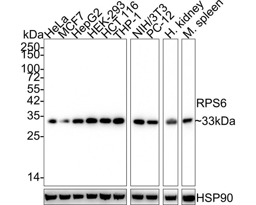 Ribosomal Protein S6/RPS6 Antibody (A6B9-R) Western Blot: Ribosomal Protein S6/RPS6 Antibody (A6B9-R) [NBP3-32918]