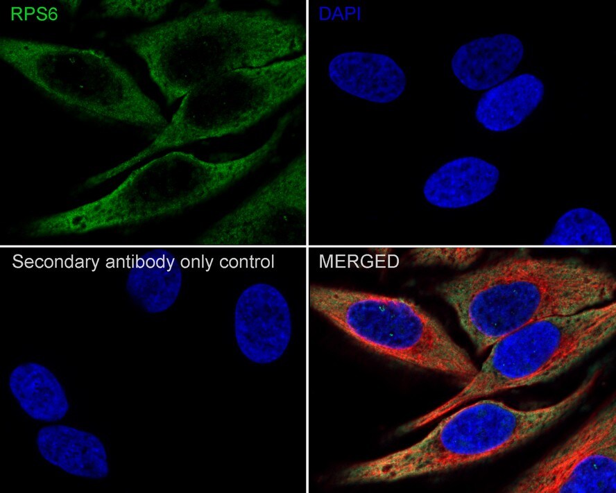 Ribosomal Protein S6/RPS6 Antibody (A6B9-R)