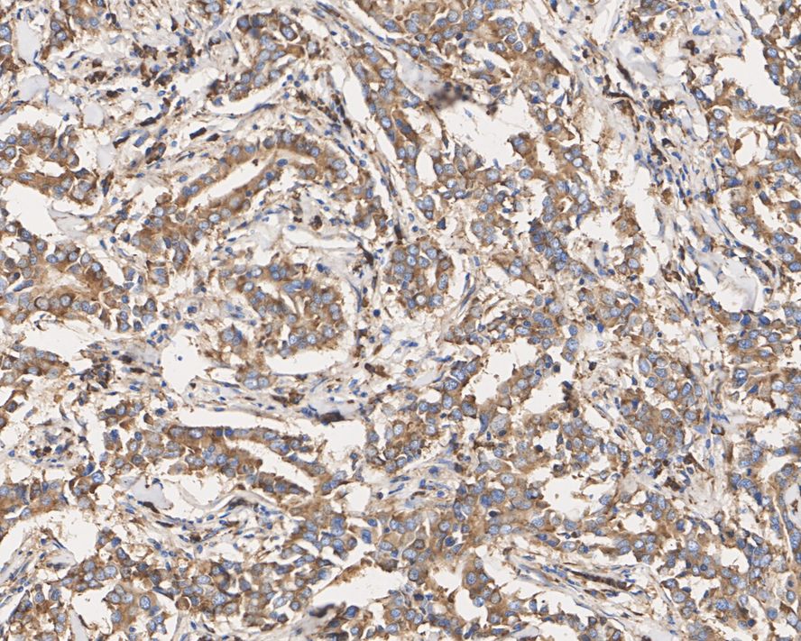 Ribosomal Protein S6/RPS6 Antibody (A6B9-R)