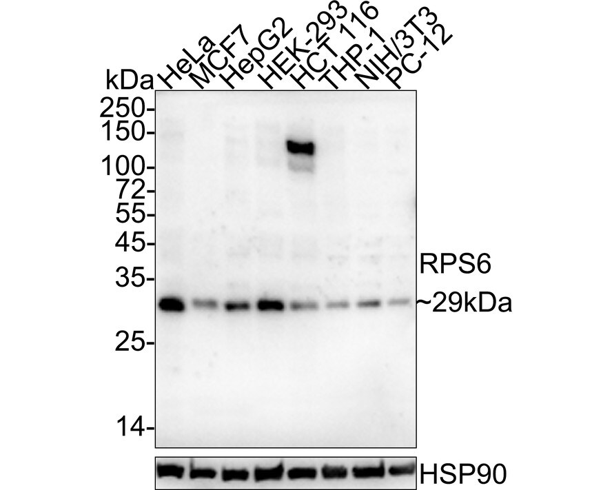 Ribosomal Protein S6/RPS6 Antibody (A6B8-R) Western Blot: Ribosomal Protein S6/RPS6 Antibody (A6B8-R) [NBP3-32919]
