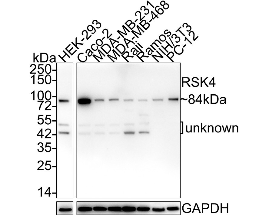 RSK4 Antibody (PSH02-04) Western Blot: RSK4 Antibody (PSH02-04) [NBP3-32920]