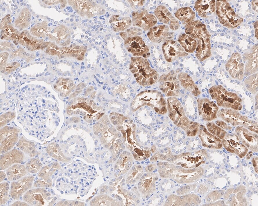 RSK4 Antibody (PSH02-04)