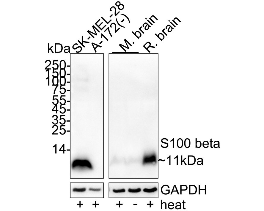 S100B Antibody (PD00-11) Western Blot: S100B Antibody (PD00-11) [NBP3-32924]