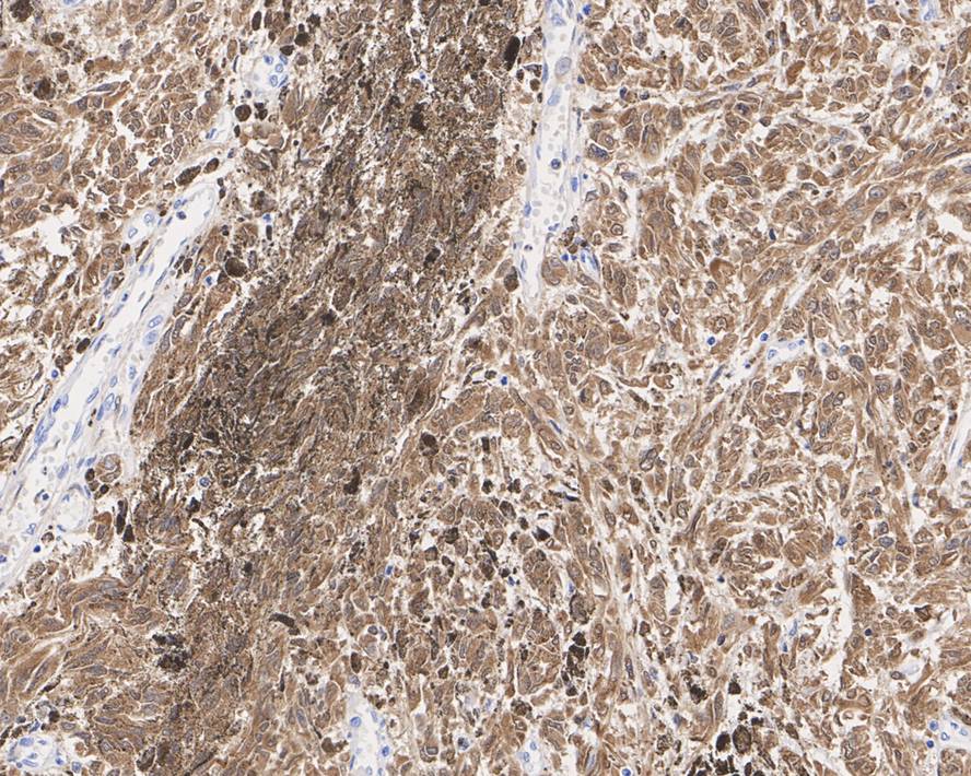 S100B Antibody (PD00-11)