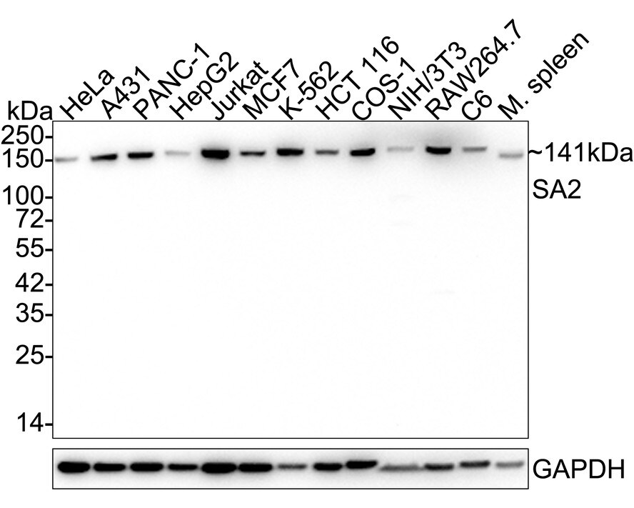 STAG2 Antibody (JE57-34) Western Blot: STAG2 Antibody (JE57-34) [NBP3-32925]
