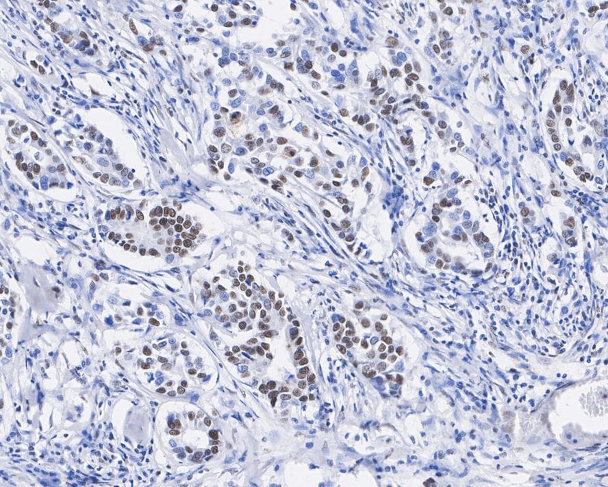 STAG2 Antibody (JE57-34)