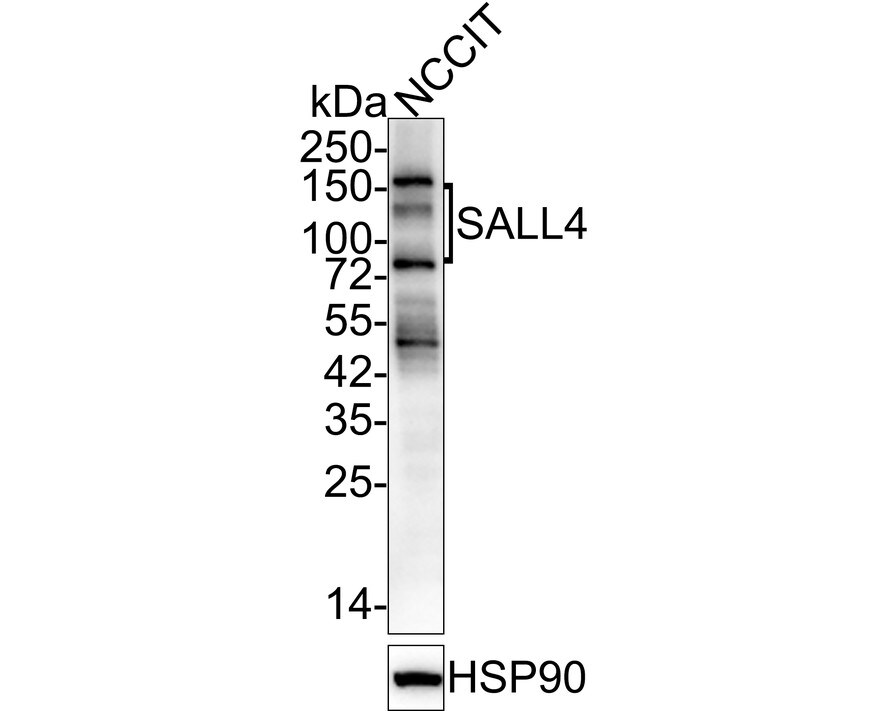 SALL4 Antibody (A9G9-R) Western Blot: SALL4 Antibody (A9G9-R) [NBP3-32926]