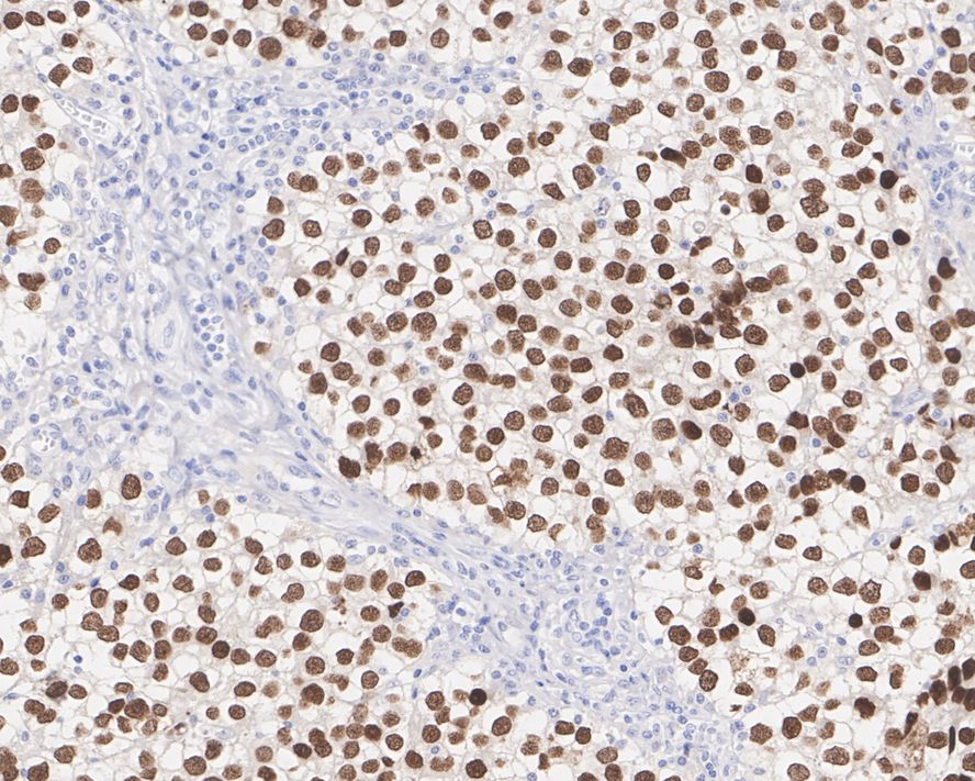 SALL4 Antibody (A9G9-R)
