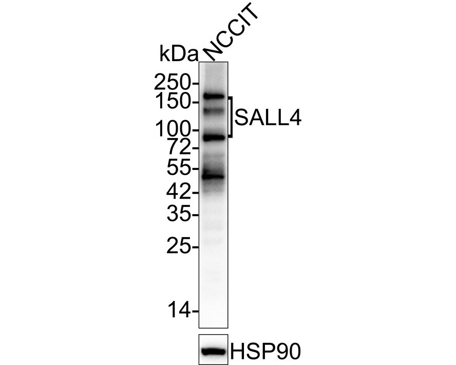 SALL4 Antibody (A7A7-R) Western Blot: SALL4 Antibody (A7A7-R) [NBP3-32927]