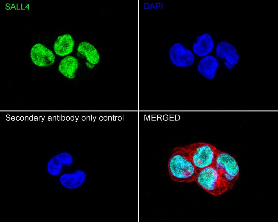 SALL4 Antibody (A7A7-R)