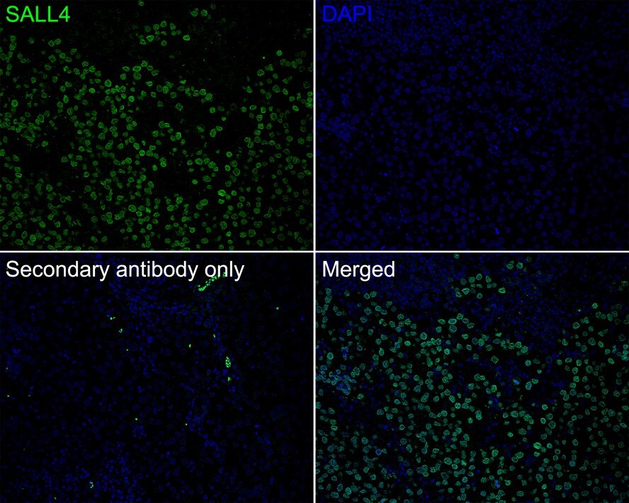 SALL4 Antibody (A7A7-R)