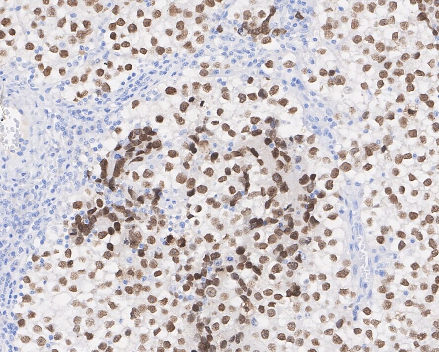 SALL4 Antibody (A7A7-R)