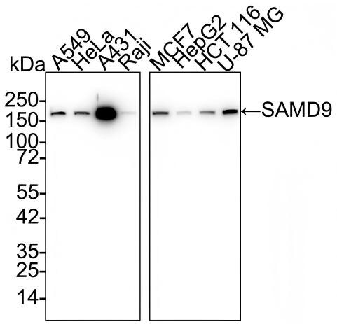 SAMD9 Antibody (PSH02-75) Western Blot: SAMD9 Antibody (PSH02-75) [NBP3-32928]