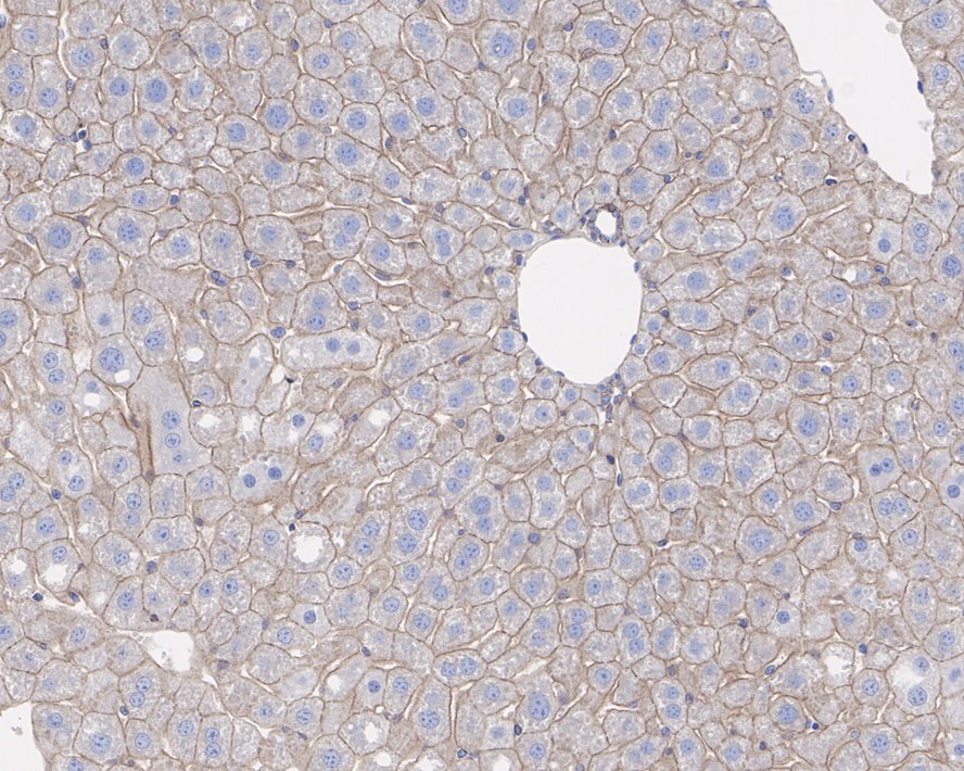DLG1 Antibody (JE39-74)