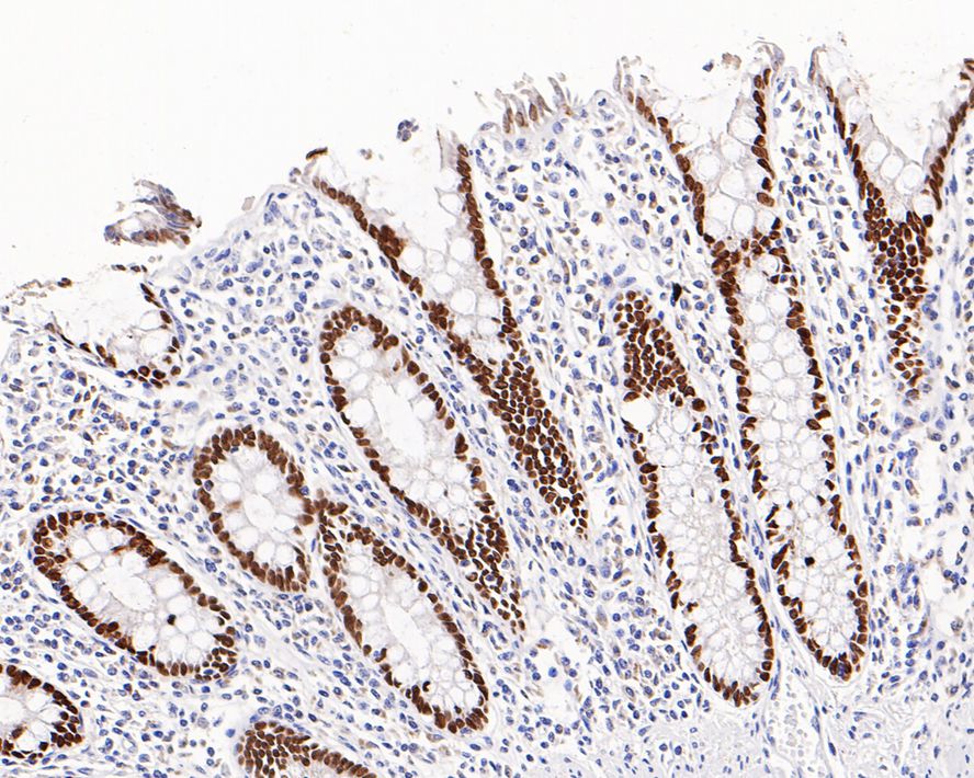 SATB2 Antibody (PD01-42)