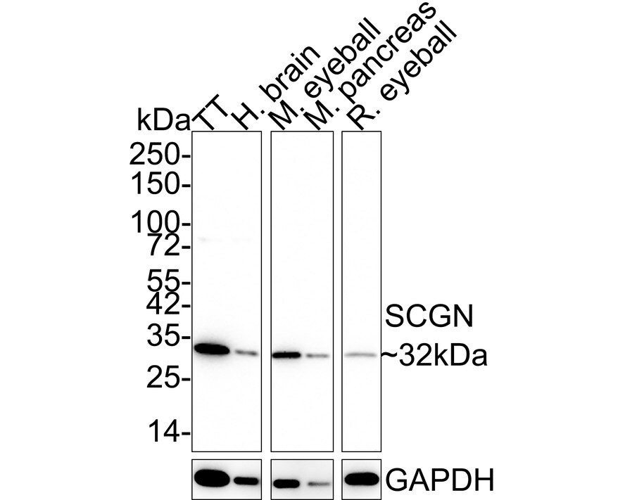 Secretagogin Antibody (JE60-48) Western Blot: Secretagogin Antibody (JE60-48) [NBP3-32933]