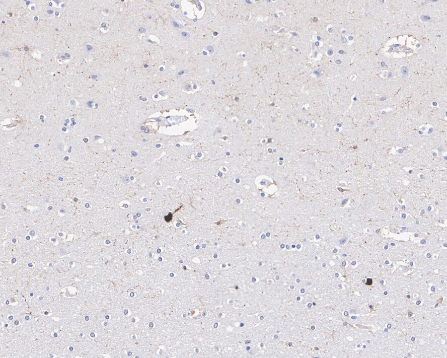 Secretagogin Antibody (JE60-48)